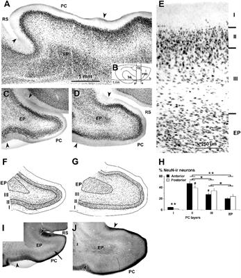 Distribution of GABAergic Neurons and VGluT1 and VGAT Immunoreactive Boutons in the Ferret (Mustela putorius) Piriform Cortex and Endopiriform Nucleus. Comparison With Visual Areas 17, 18 and 19